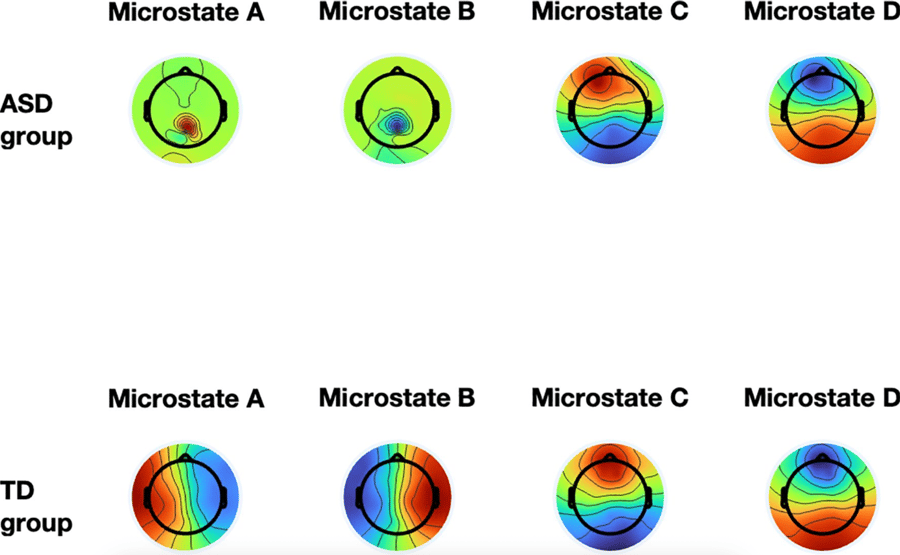 EEG Microstate 425