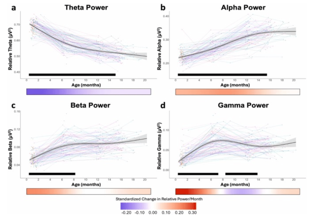 EEG study 925