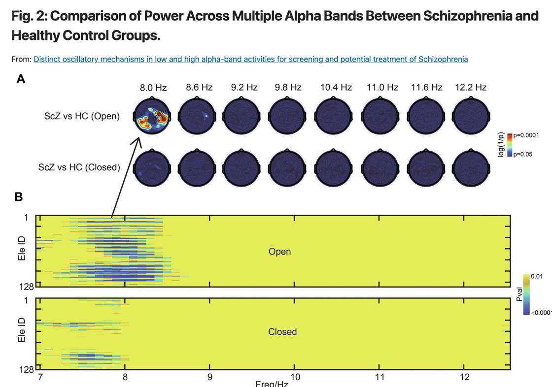 EGI Schizophrenia 625