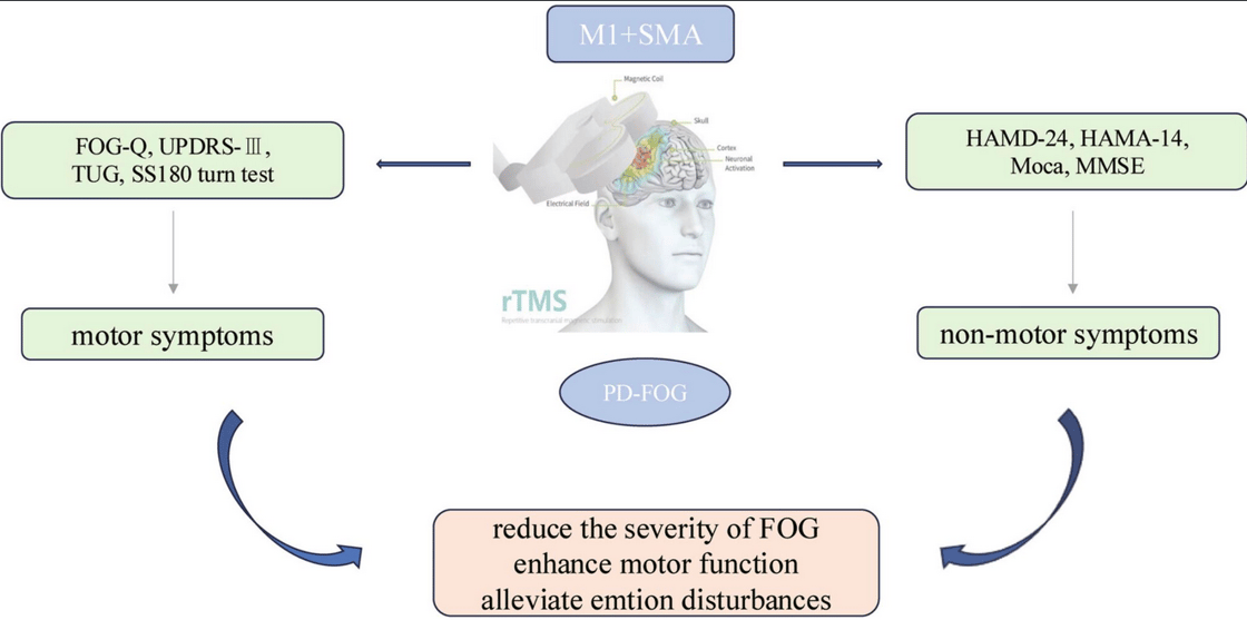 TMS research parkinsons